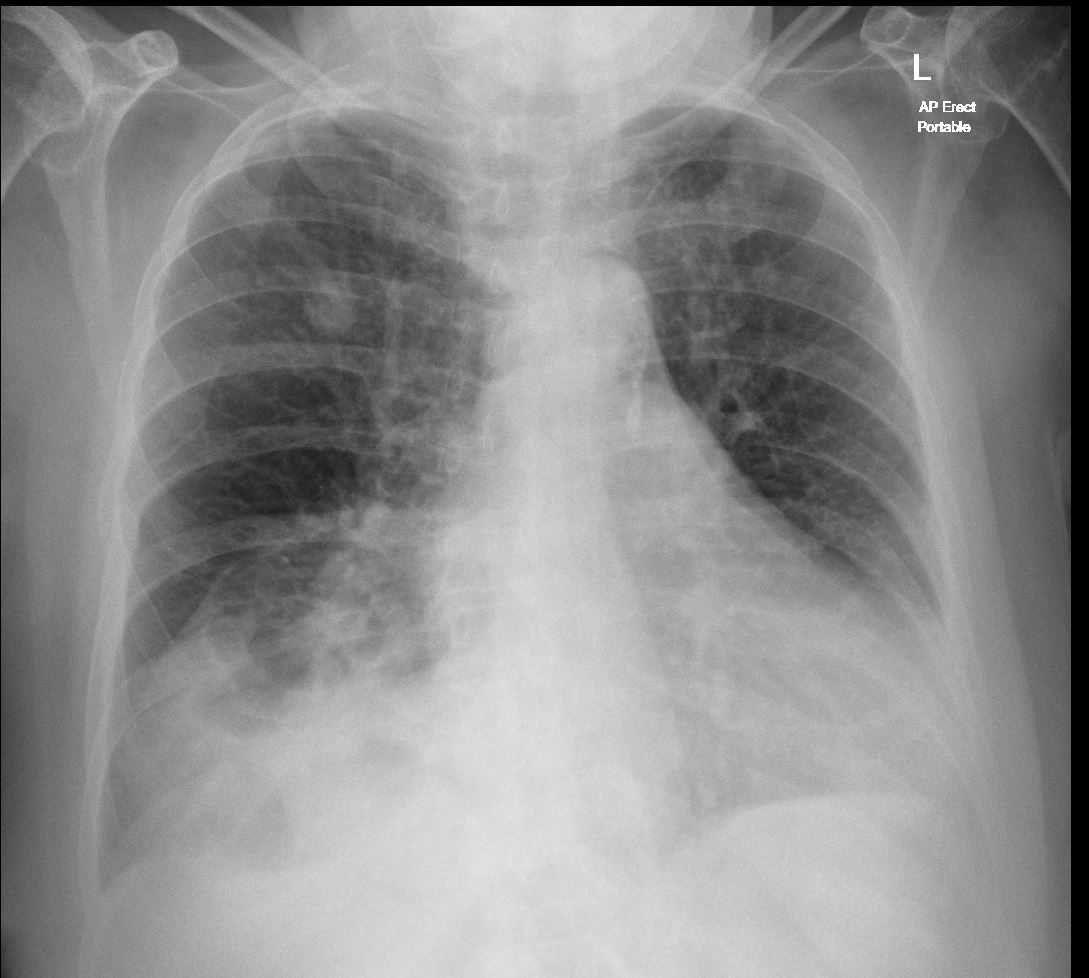 Case 7